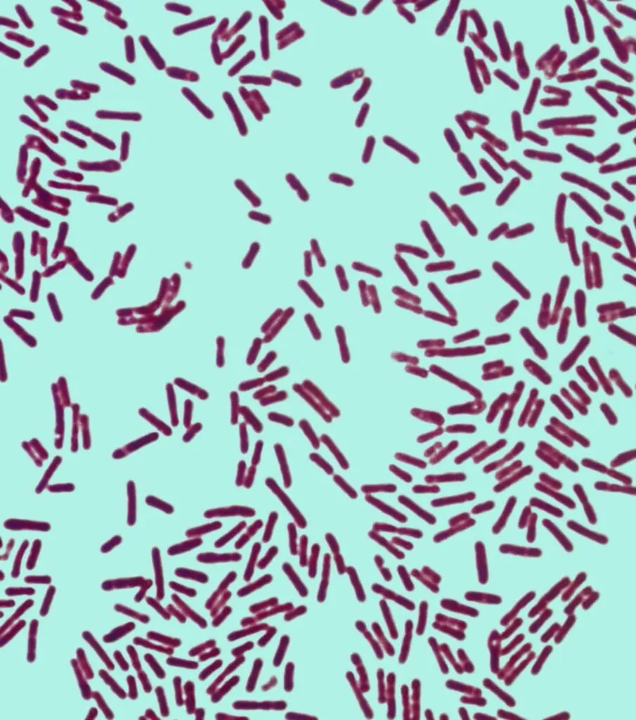 Spore-Forming Bacteria in Food Plants | Sterilex