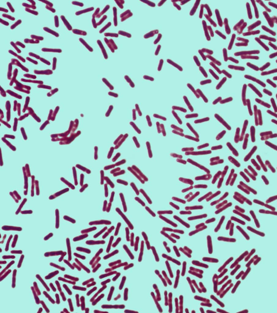 Microscopic image of red, rod-shaped bacteria spores on a light blue background. Spore-forming bacteria can be a tough, hidden menace in food processing.